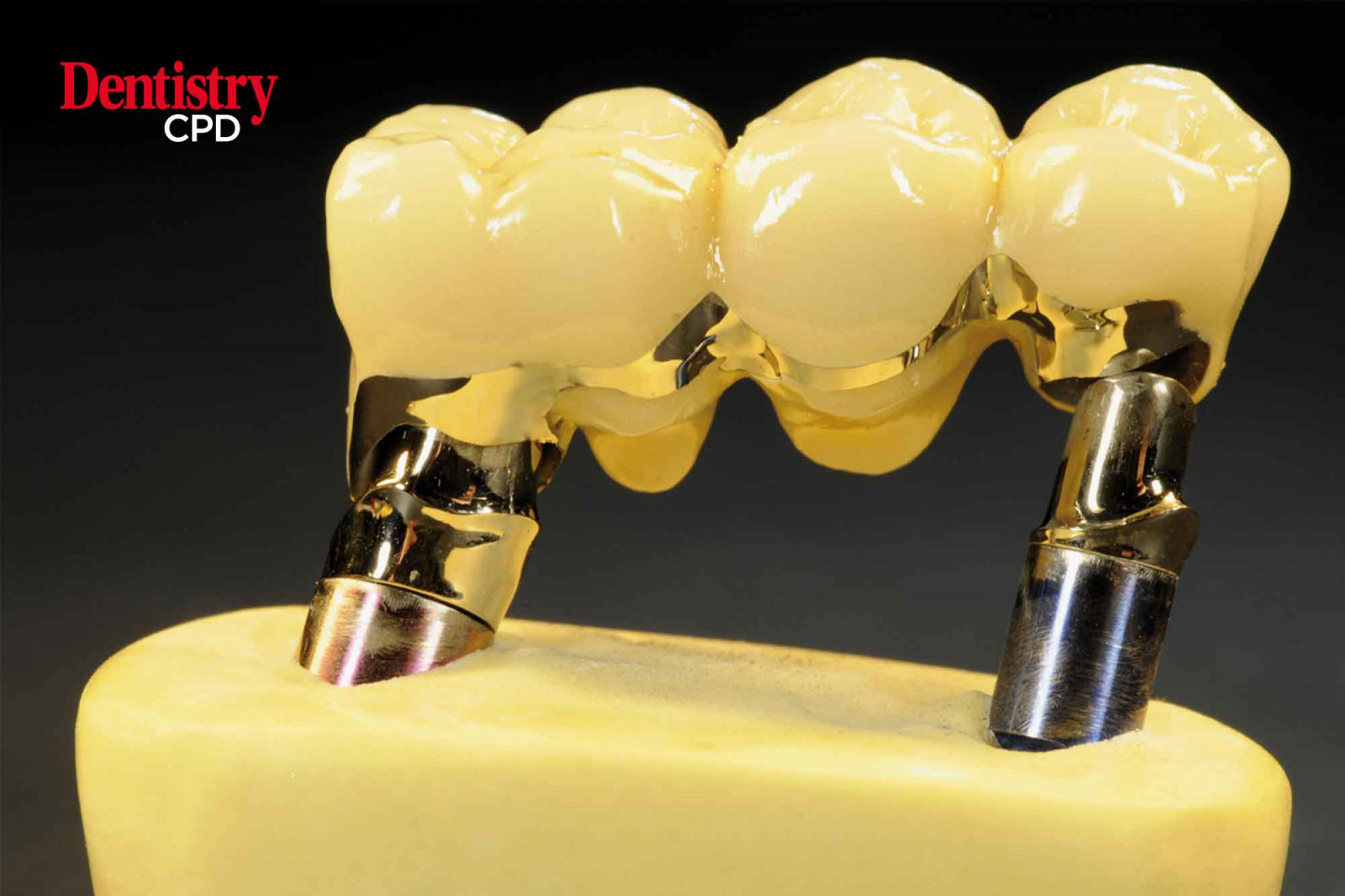 dentistry-cpd-efficient-and-aesthetically-pleasing-conventional