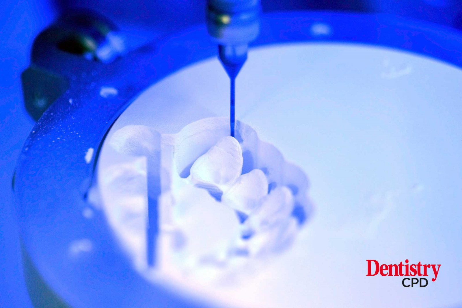 Dentistry CPD - Evaluation of a CAD/CAM denture technology for implant ...