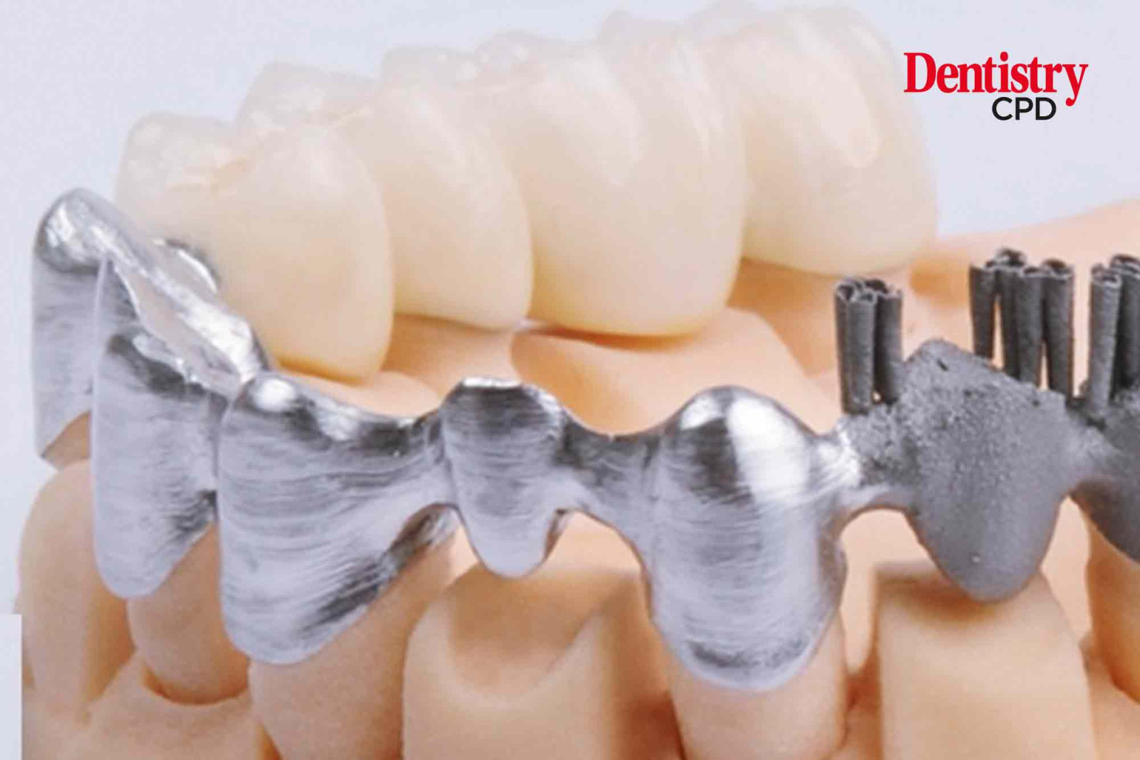 Dentistry CPD A literature review of 3D printing materials in