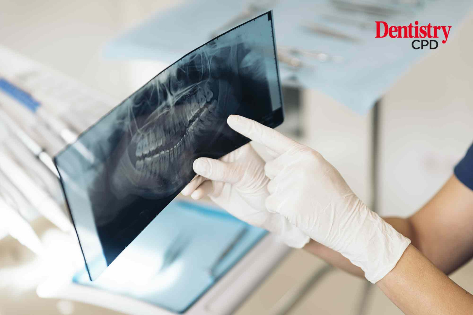 Radiography Qualification For Dental Nurses