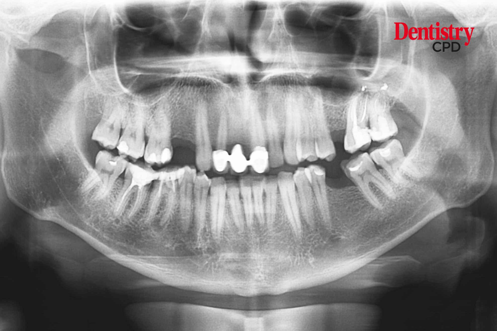 Dentistry CPD Dental radiography safe use of Xray equipment