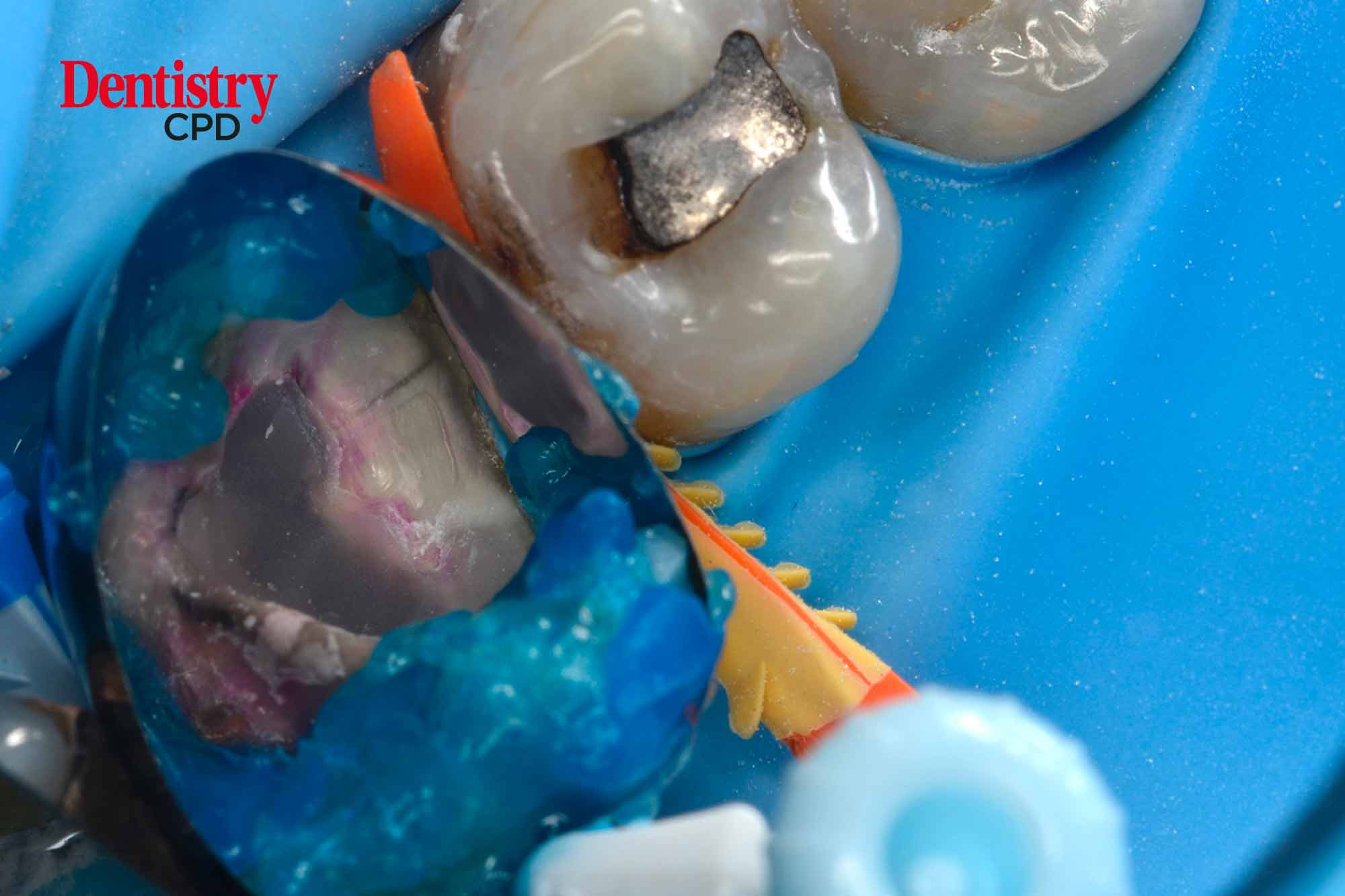 Dentistry CPD Restoring aesthetics and function