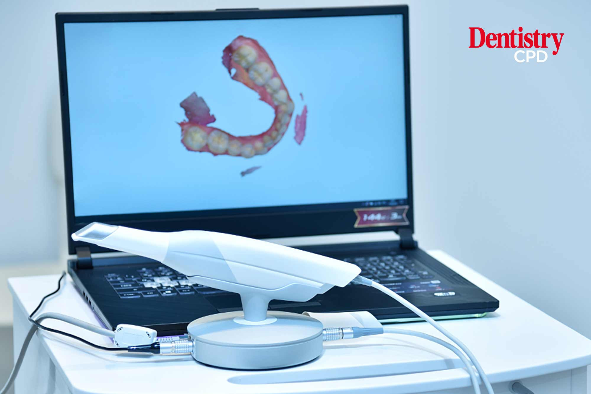 Dentistry CPD Intraoral scanners a review of the key benefits