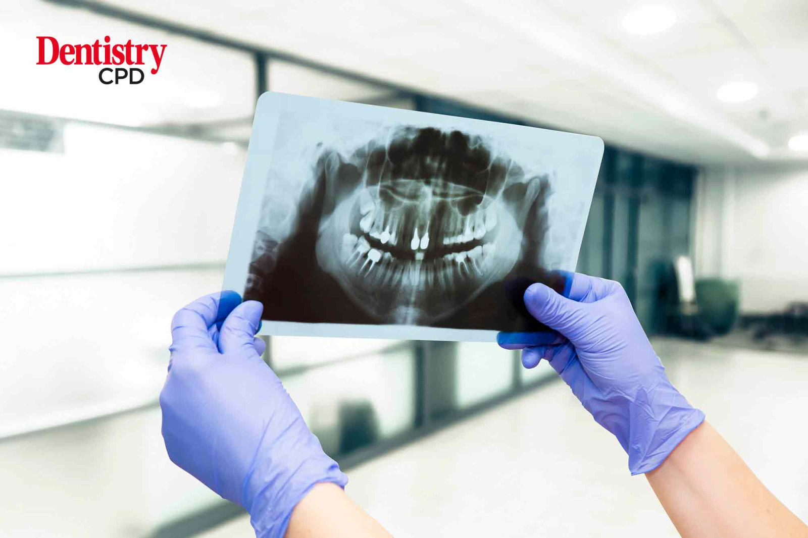 Dentistry CPD Dental radiography from a dental nurse’s perspective