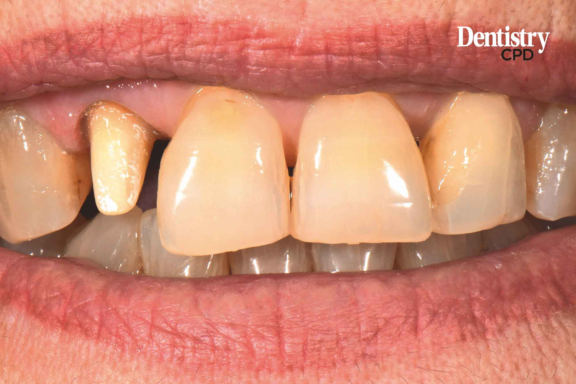 Dentistry CPD CPD Team 2023 Technician precisely controlling shade