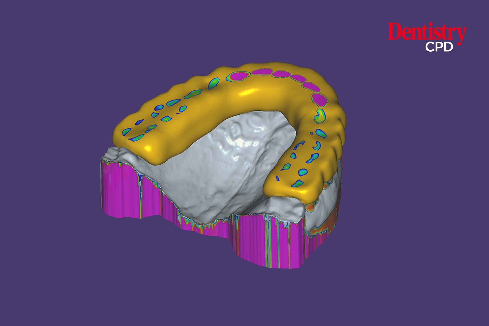 Dentistry CPD CPD Team 2023 Technician: occlusal splints digital Dentistry CPD CPD Team 2023 Technician: occlusal splints digital