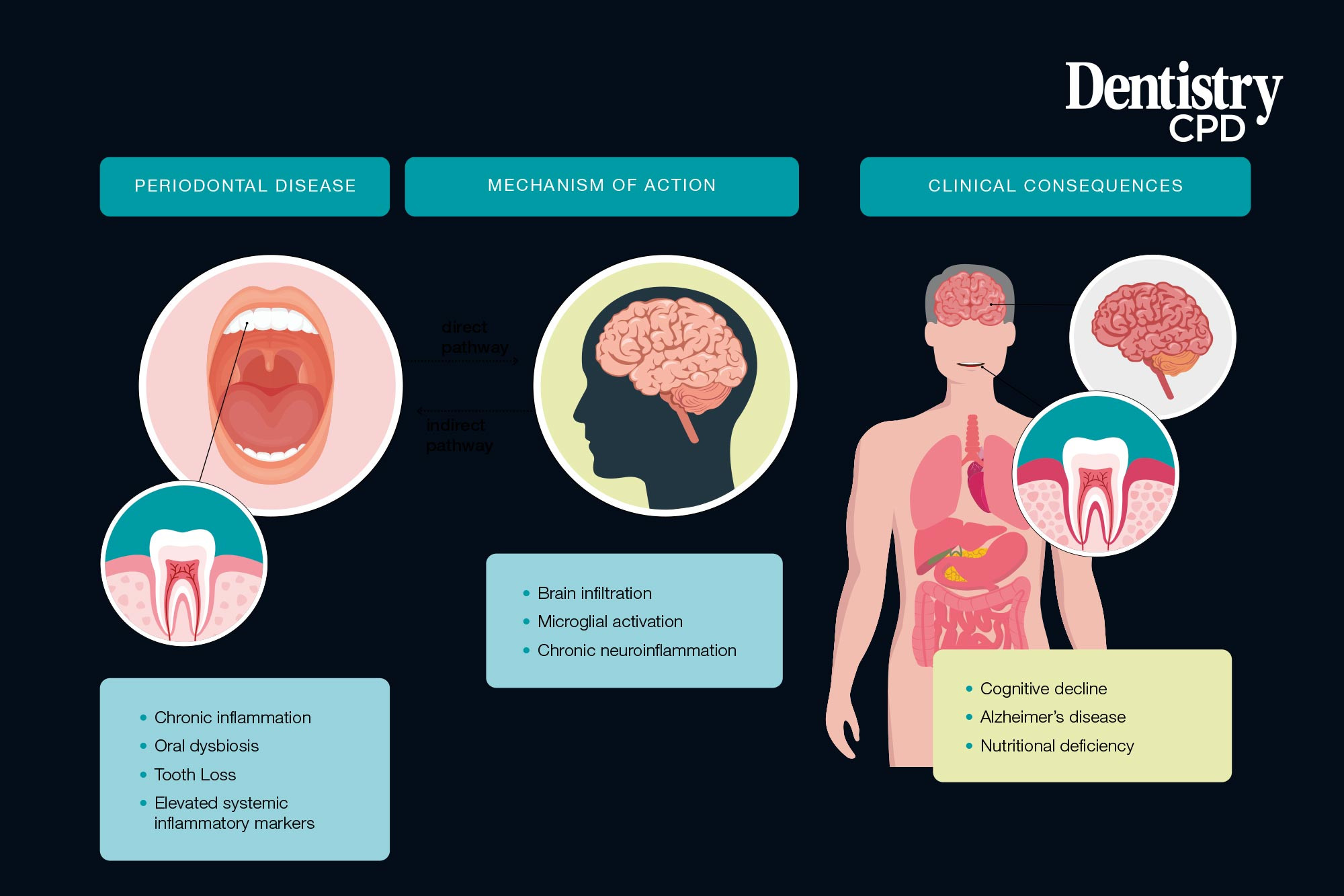 Dentistry CPD - The oral-brain axis